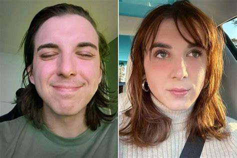 Trans MrBeast star Kris Tyson shares before and after photos